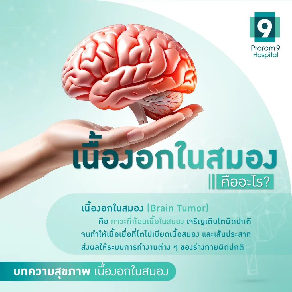 เนื้องอกในสมอง-1024x1024.webp