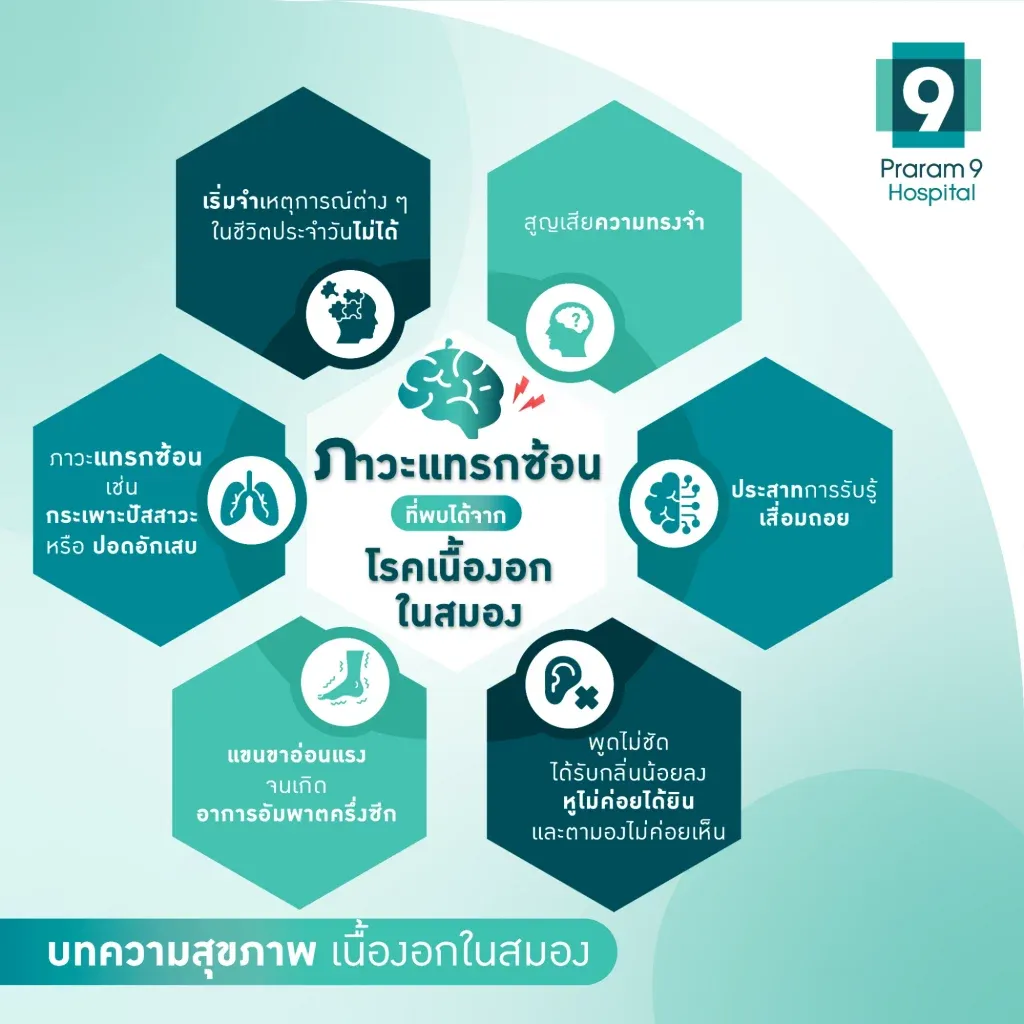 โรคเนื้องอกในสมอง-1024x1024.webp