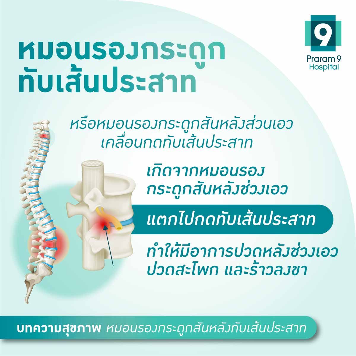หมอนรองกระดูกสันหลัง-Fig-1_m.jpg