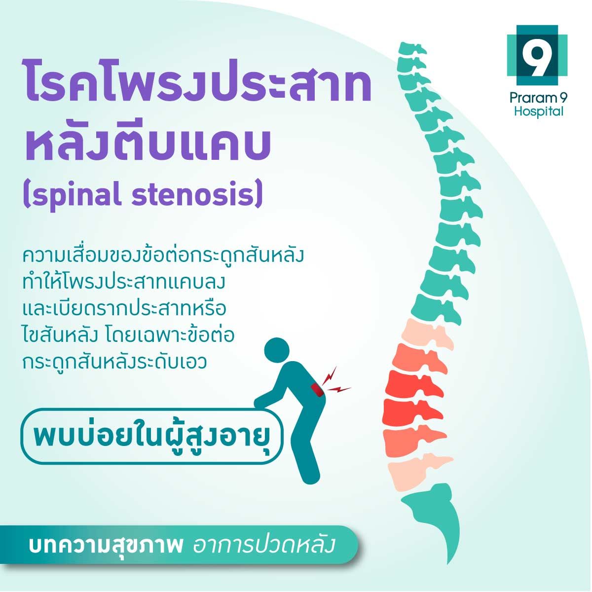 ปวดหลังFig-3.1.jpg