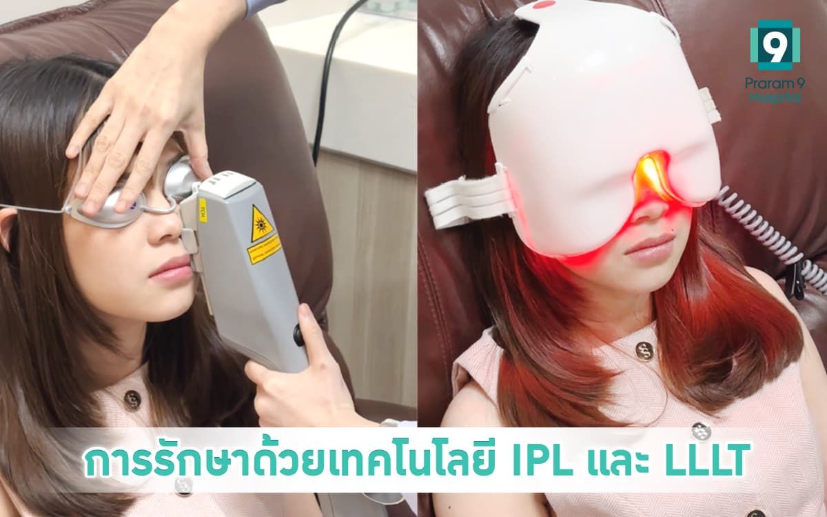 การรักษาด้วย IPL + LLLT