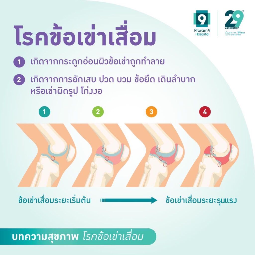 Knee-1024x1024.jpg