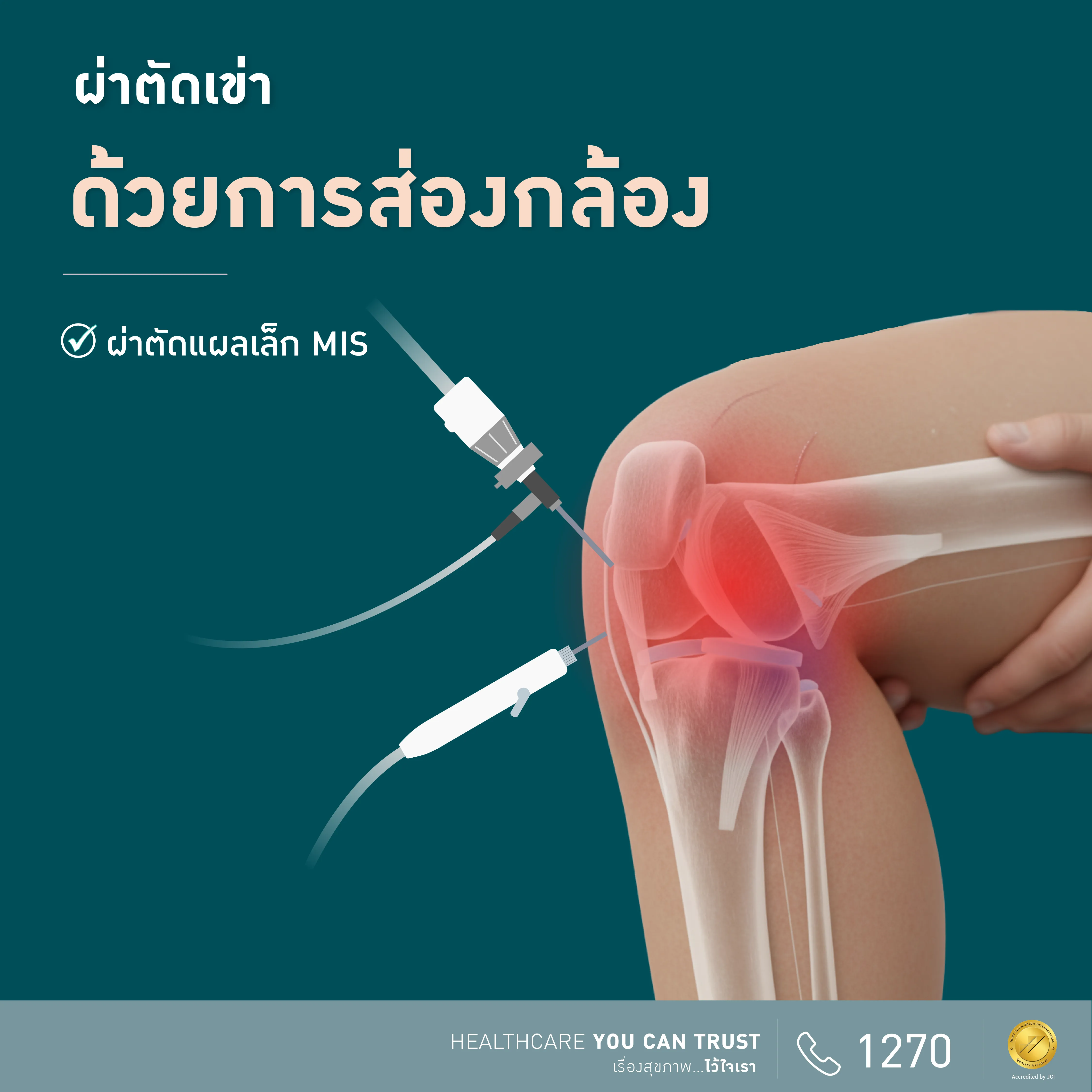 โปรแกรมผ่าตัดเข่าด้วยการส่องกล้อง 