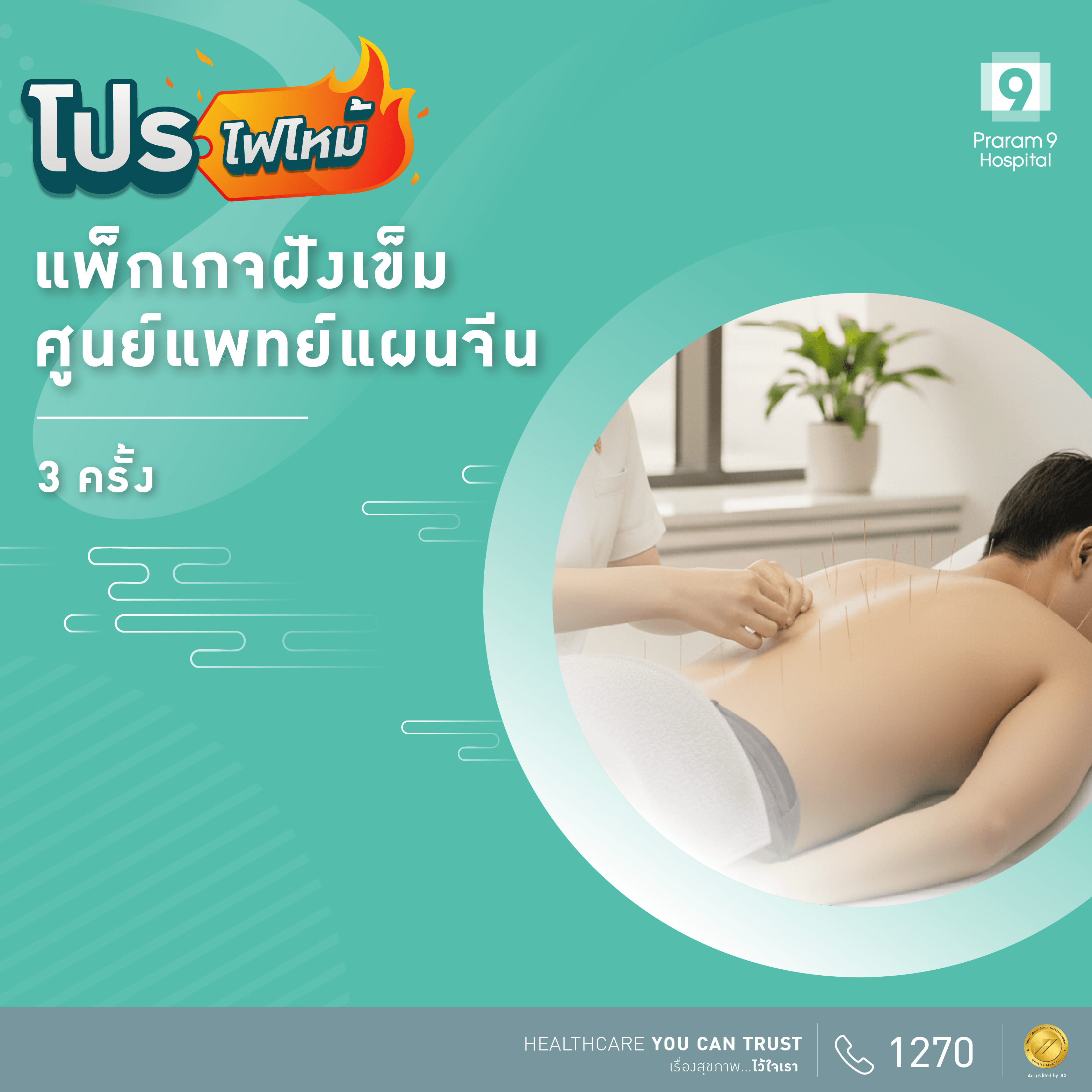 ฝังเข็มแพทย์แผนจีน