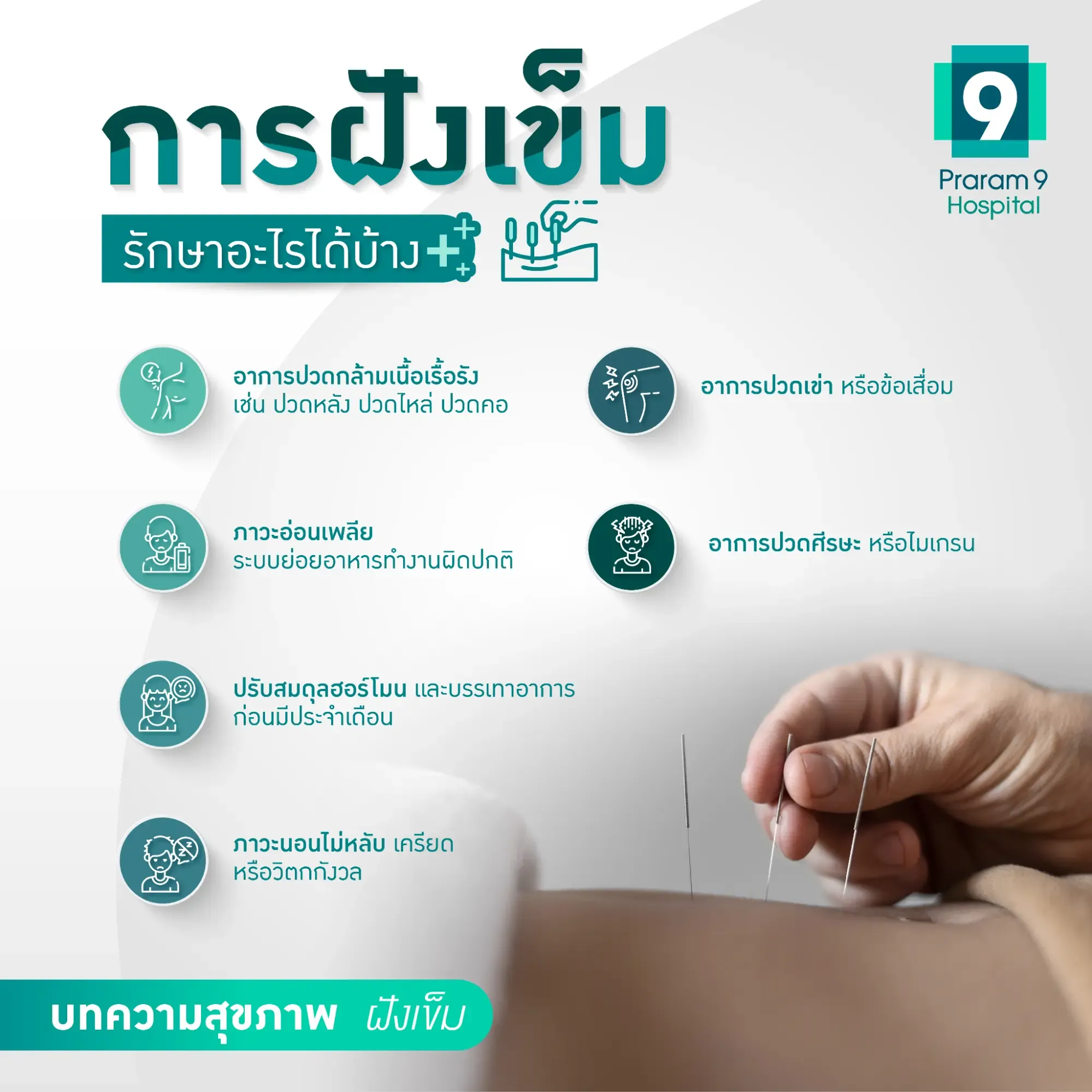 การฝั่งเข็มรักษาโรคปวดหลัง