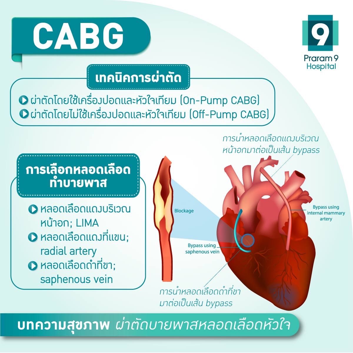 cabg-3.jpg