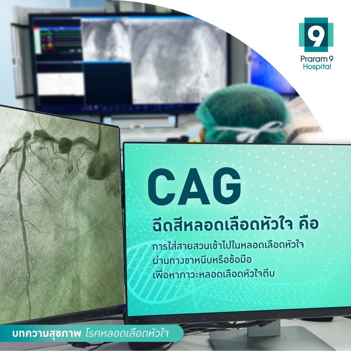 fig4-เจ็บหน้าอกจากโรคหลอดเลือดหัวใจ.jpg