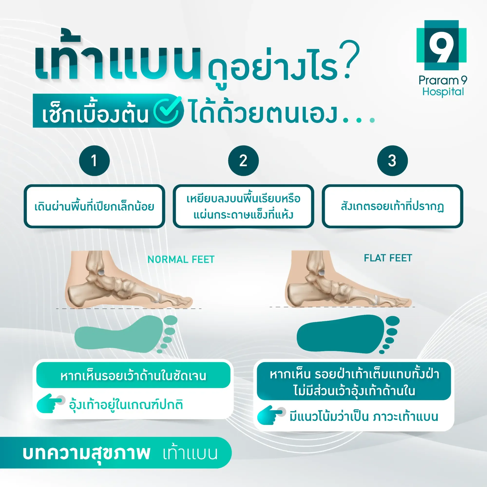 เท้าแบน