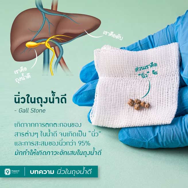 gallstone-1.jpg