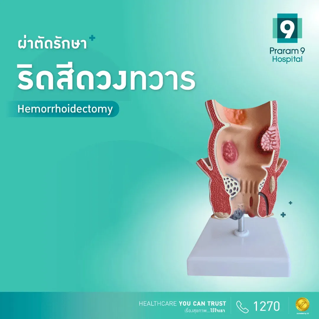 โปรแกรมผ่าตัดริดสีดวงทวาร