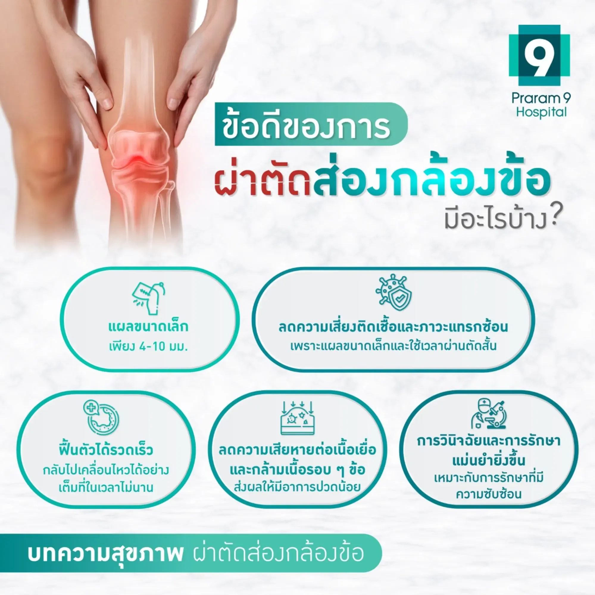 arthroscopy knee คือ