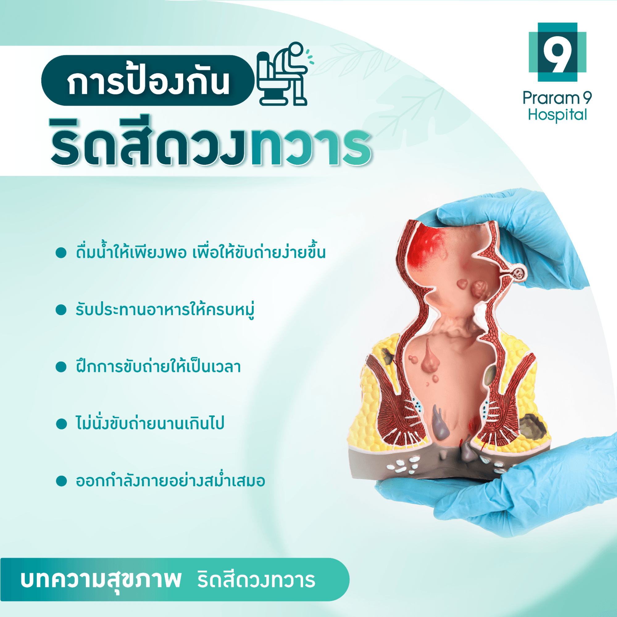 การป้องกันริดสีดวง