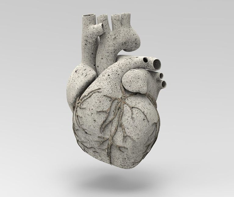 run-heart-attack-2.jpg