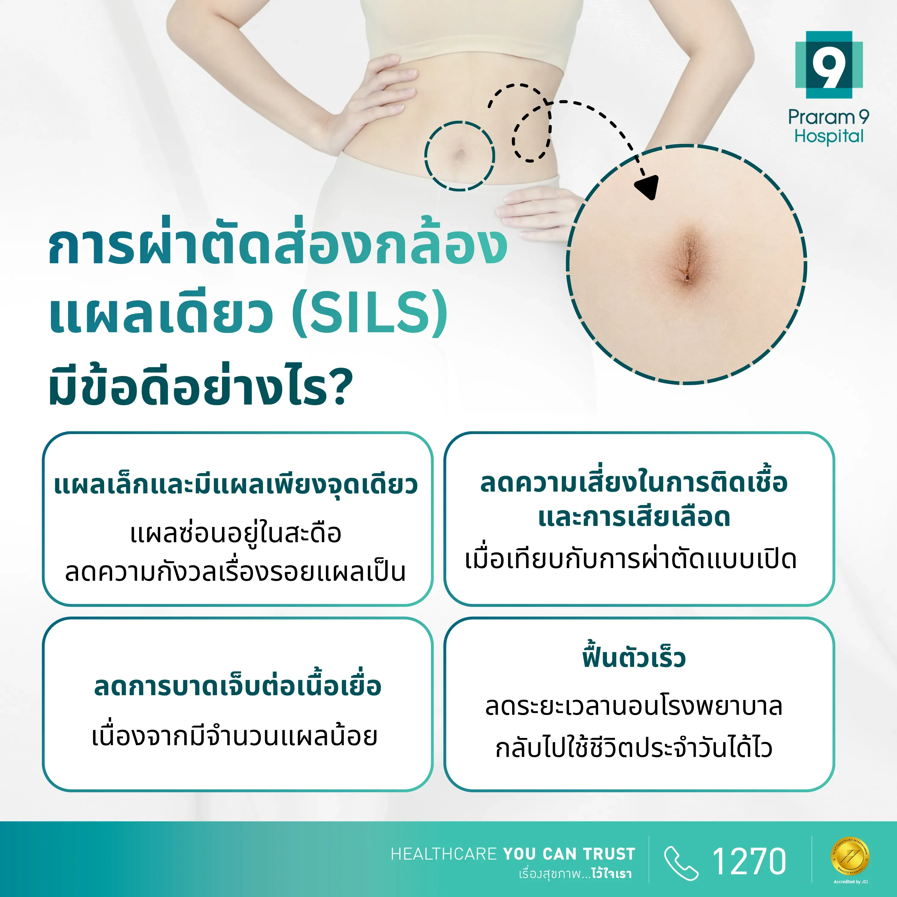 ข้อดีของการผ่าตัดส่องกล้องแผลเดียว (SILS)