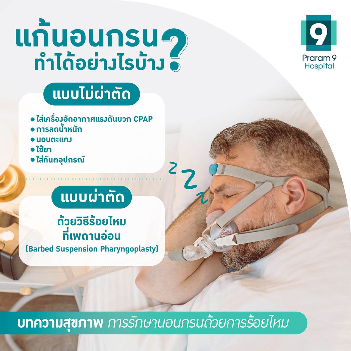 sling-snoreplasty-2.jpg