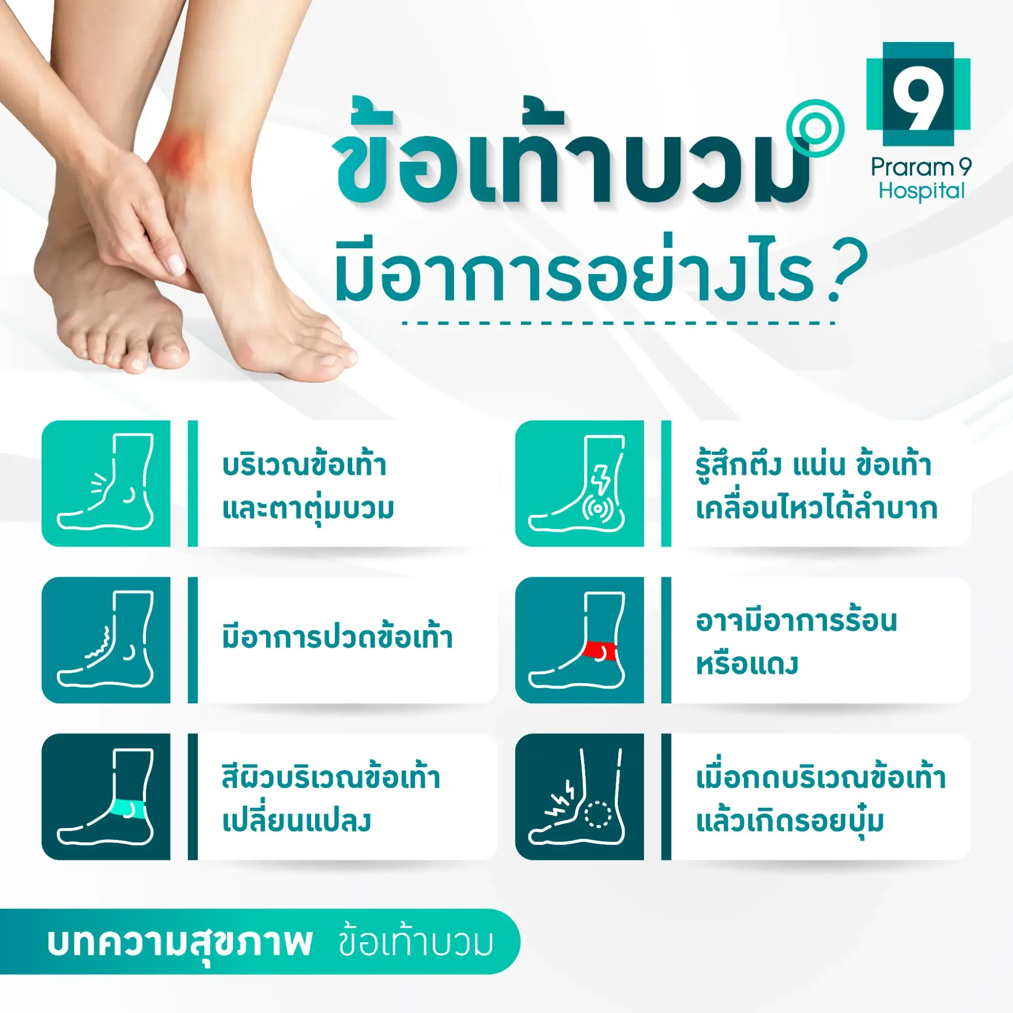 อาการเท้าบวม