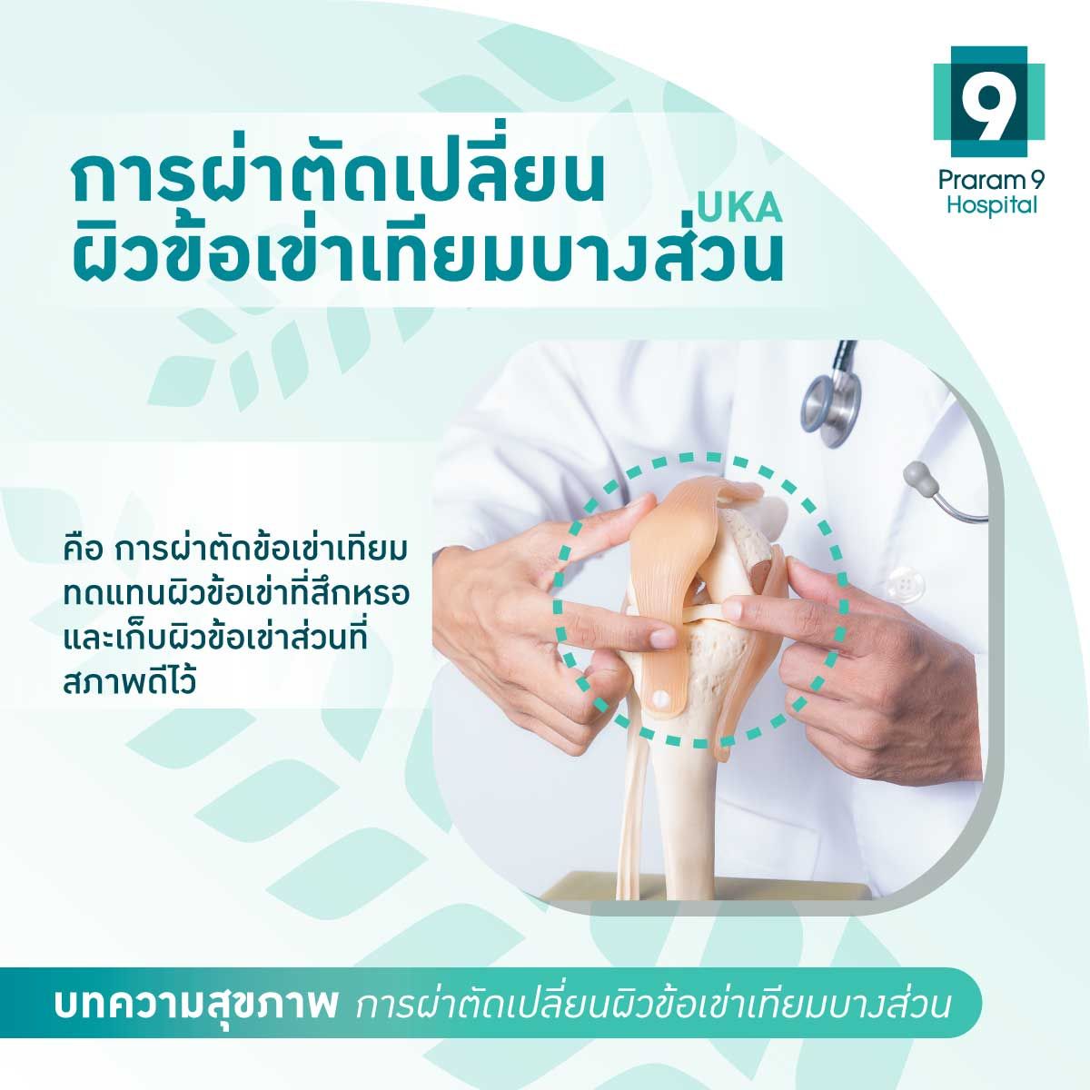 uka-unicompartment-knee-arthroplasty-2.jpg