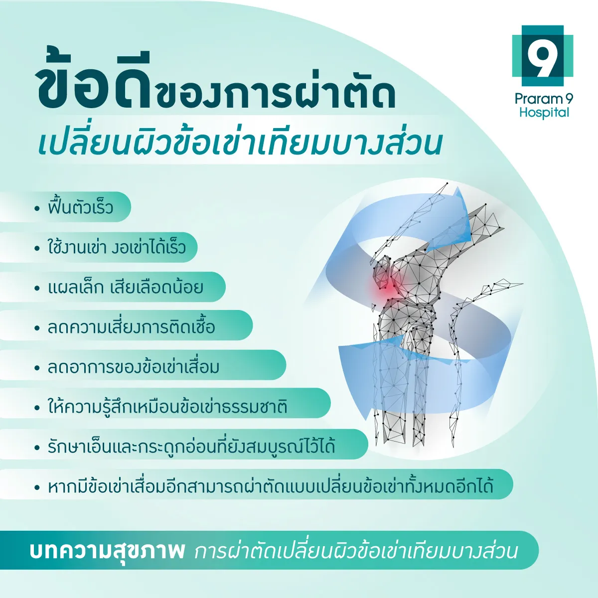 uka-unicompartment-knee-arthroplasty-3.webp