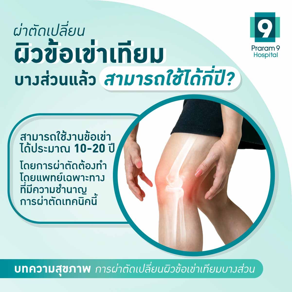 uka-unicompartment-knee-arthroplasty-4.jpg