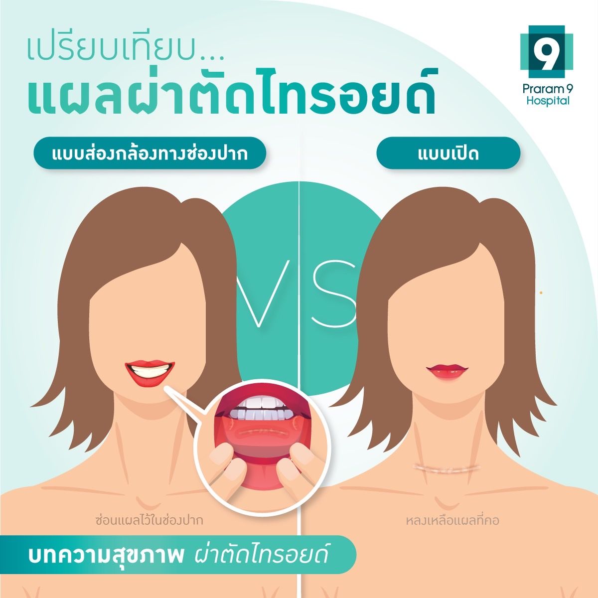wp-thyroid-surgery-compare.jpg